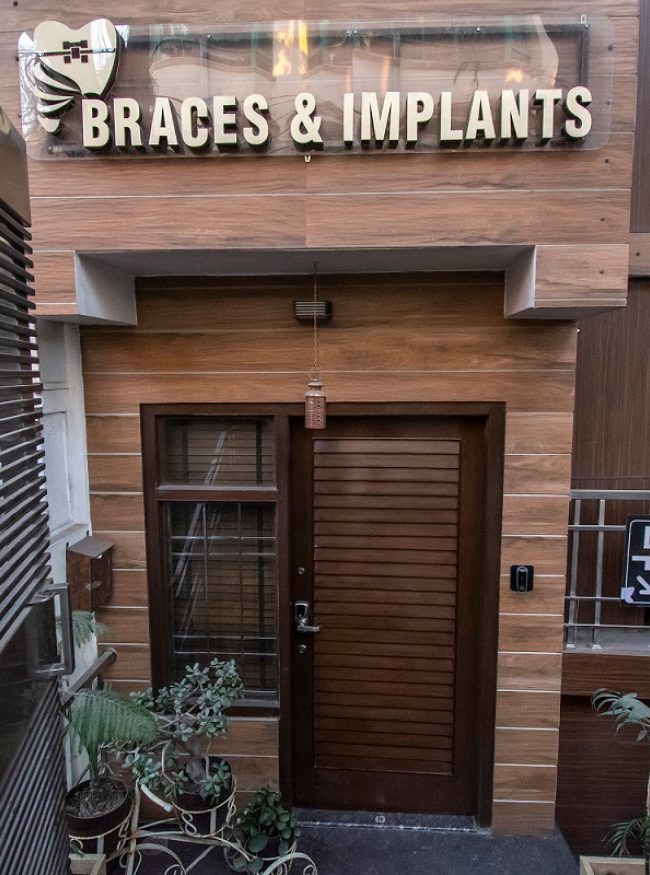 Braces and Implants feature